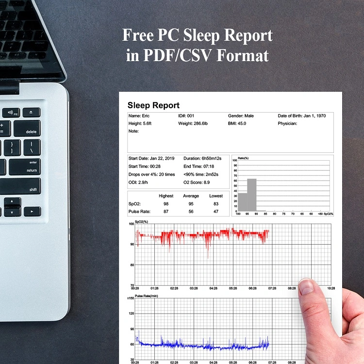 Manufacture Price Wrist Sleep Wireless Oximeter with PC Report Continuous Pulse Monitor with CE&FDA